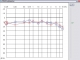 HEAD Audiometer