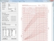 Growth Chart SDK