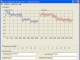 Home Audiometer