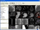 PaxeraHealth DICOM Viewer