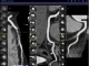 syngo.via - CT Coronary Analysis Client