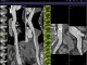 syngo.via - CT Vascular Analysis Client