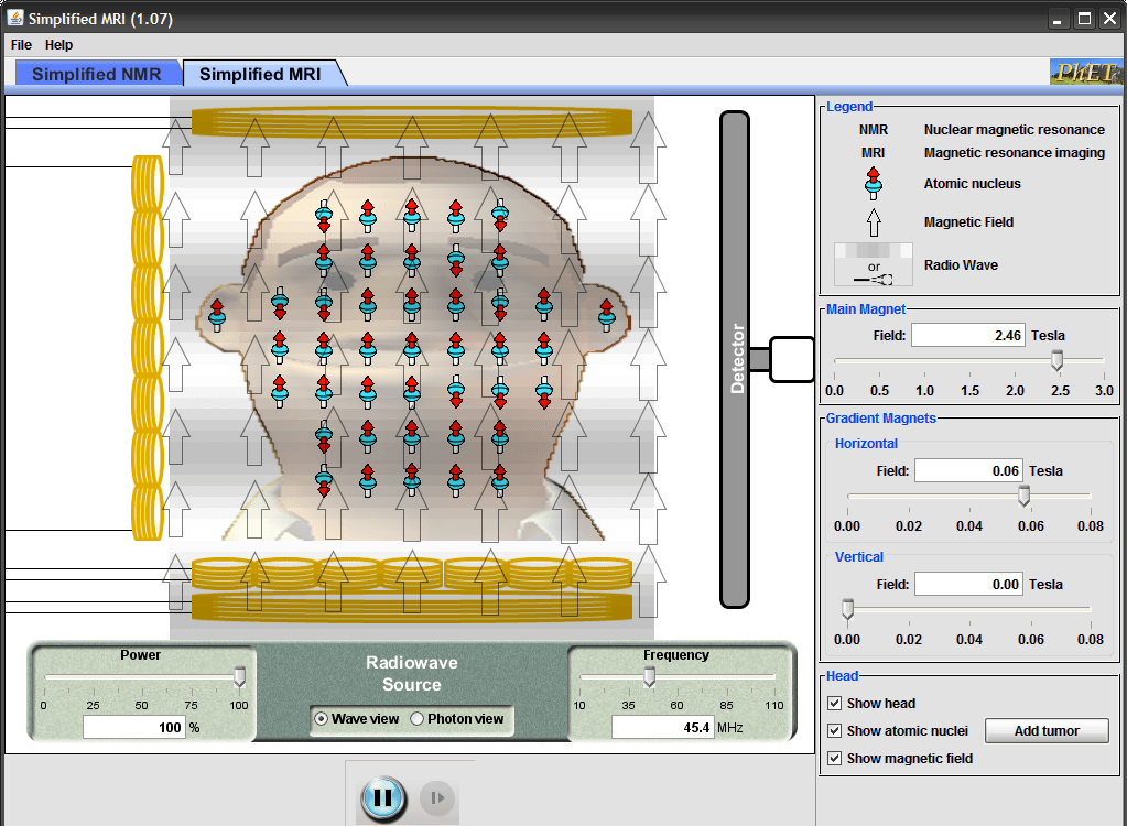 Simplified MRI