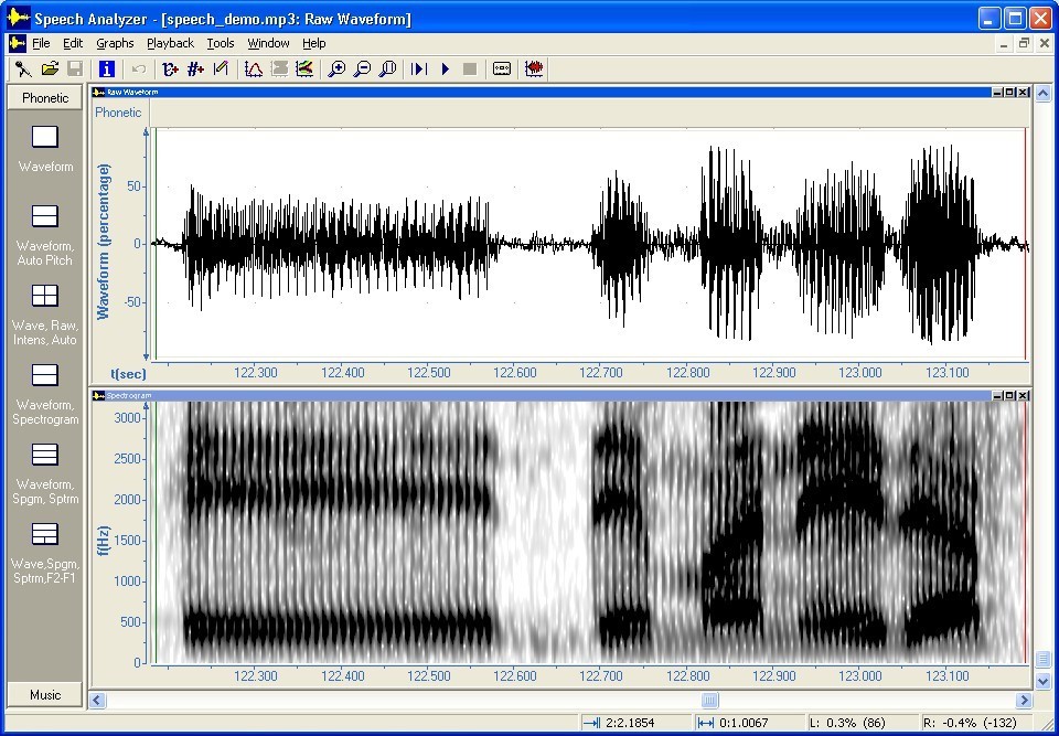 Phonetic Spectrogram