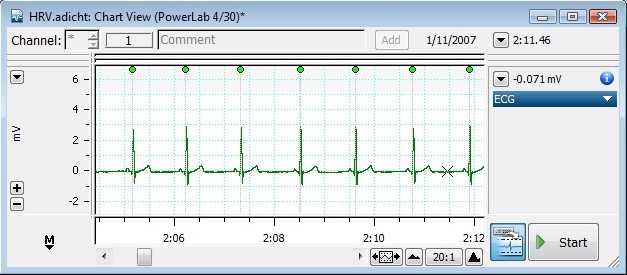 Analysis Window