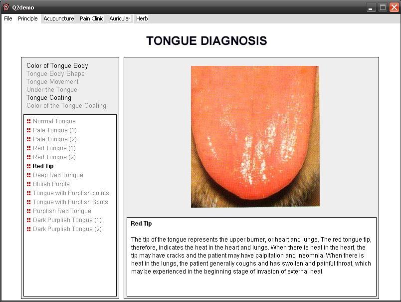 Tongue diagnostics