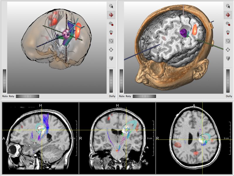 Various visual approaches for neuro-visualization